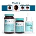 Hair Fall Solution, Male STAGE 2