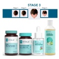 Hair Fall Solution, Male STAGE 3