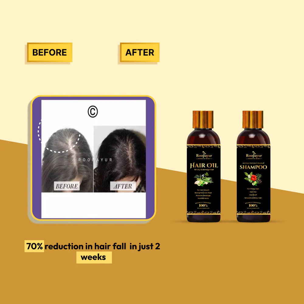 3 - Roopayur Anti Hairfall Combo,  2 Piece(s)/Pack  Hair Oil + Anti Hair fall & Anti Dandruff Shampoo 