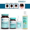 3 - HK Vitals Hair Fall Solution,  STAGE 4 