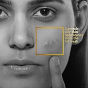 2 - VLCC Clinic Anti Acne Face Wash,  150 ml  for Oily & Acne-prone Skin