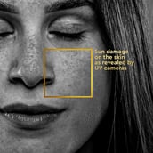 7 - VLCC Clinic ProDefence Anti Tan Sun Screen Lotion SPF25,  100 ml  Lemon Extract