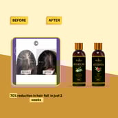 3 - Roopayur Anti Hairfall Combo, 2 Piece(s)/Pack Hair Oil + Anti Hair fall & Anti Dandruff Shampoo